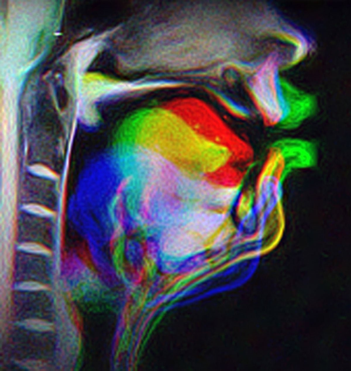 Brain Study Overturns Long-Held Beliefs About How Humans Learn Speech