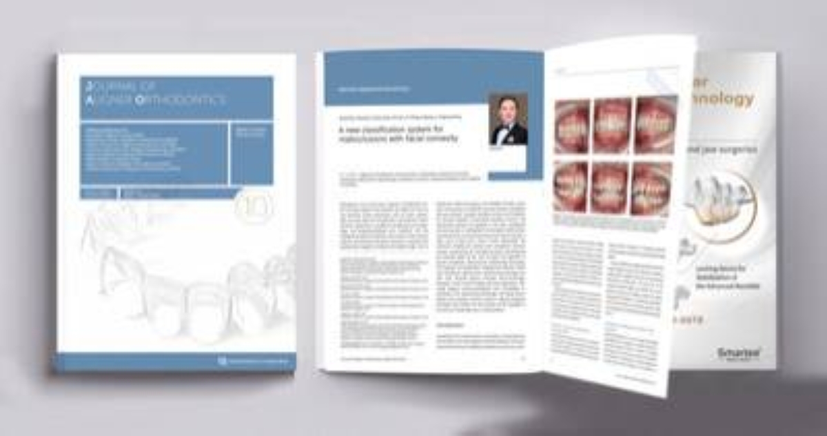 New Classification System of Malocclusions Published in the Journal of Aligner Orthodontics (JAO) by Prof. Gang Shen's Team