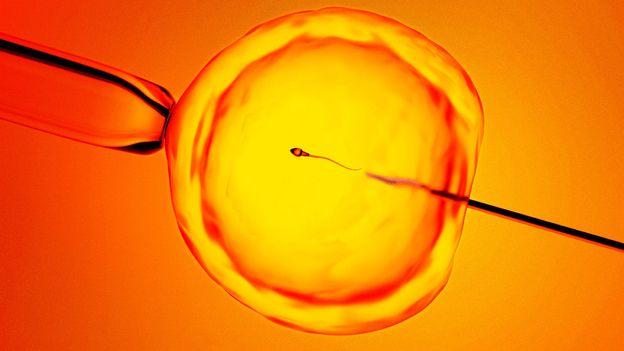 Finding 'hidden sperm': AI offers hope to men previously told they were infertile